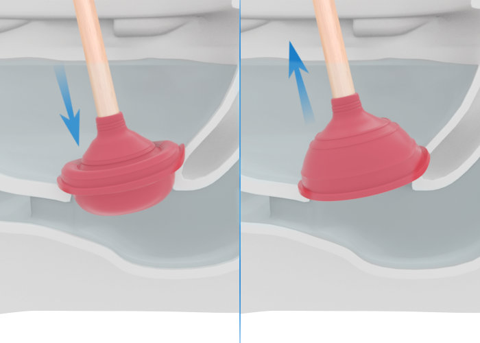 Comment déboucher un WC à l’aide d’une ventouse ?